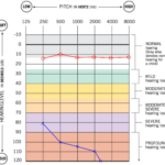 9B139 Audiogram Template | Wiring Library Throughout Blank Audiogram Template Download